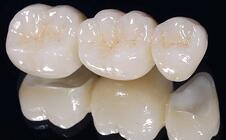 Solid Zirconia Restorations