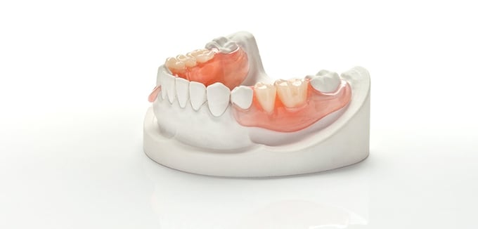 THE BEST PARTIAL DENTURE TECHNIQUE - STEP BY STEP