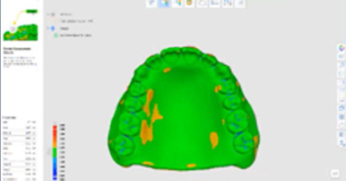 DDSLabLLC-331362-Intraoral-Scanning-Dentures-ImageA1 (1)