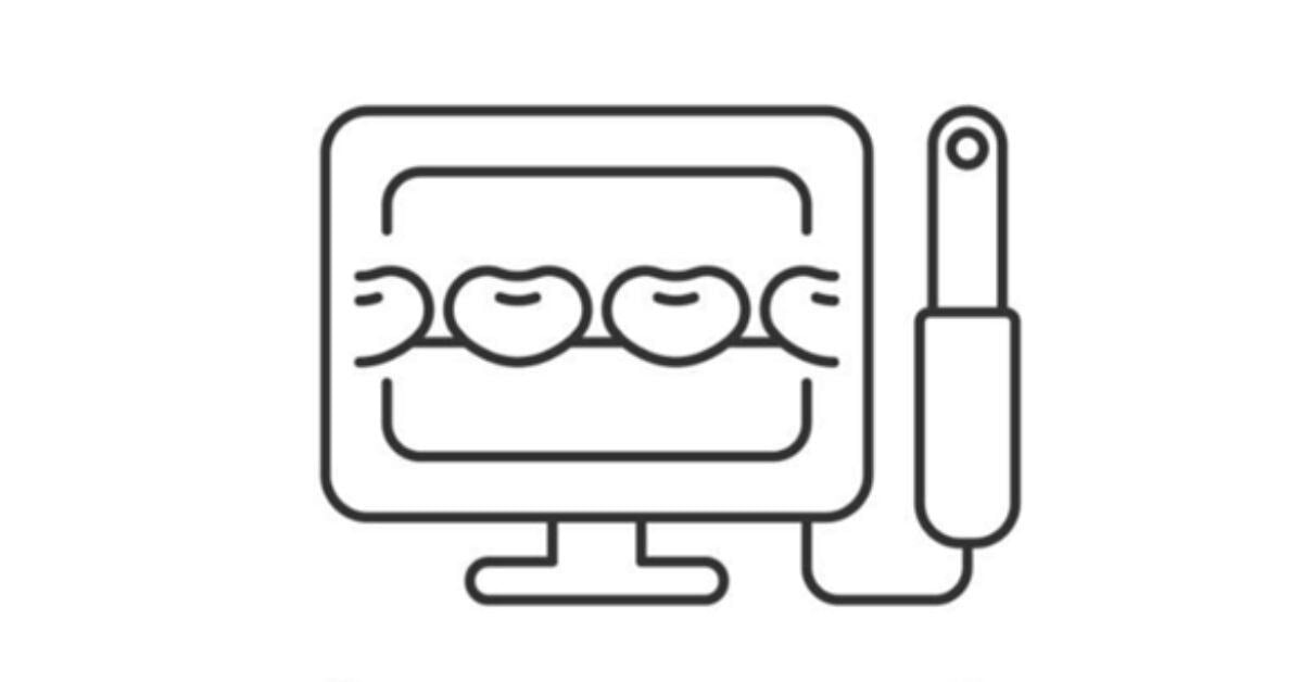 Which Intraoral Scanners Work Better for 3D Printed Digital Dentures?