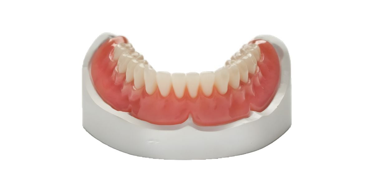5 Questions Patients Have About Removable Dentures