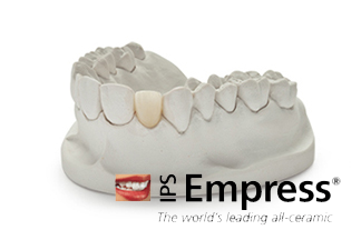 All Ceramics IPS Empress | Crowns & Bridges