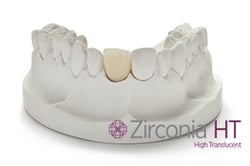 All Ceramic Zirconia High Translucent Crown and Bridge