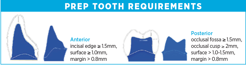 PREP TOOTH REQUIREMENTS