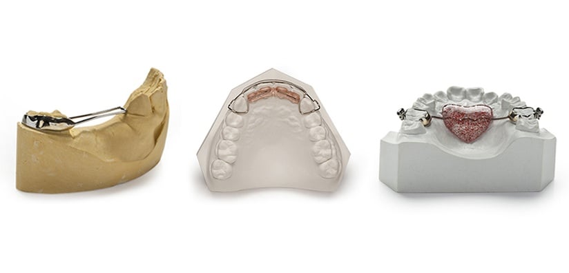 Trajtimi Ortodontik i hershem \u2013 ISUFI Studio Odontoiatrico