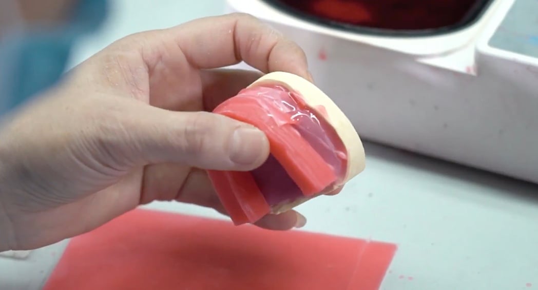 Denture Fabrication - Fabrication of Custom Tray and Bite Rim