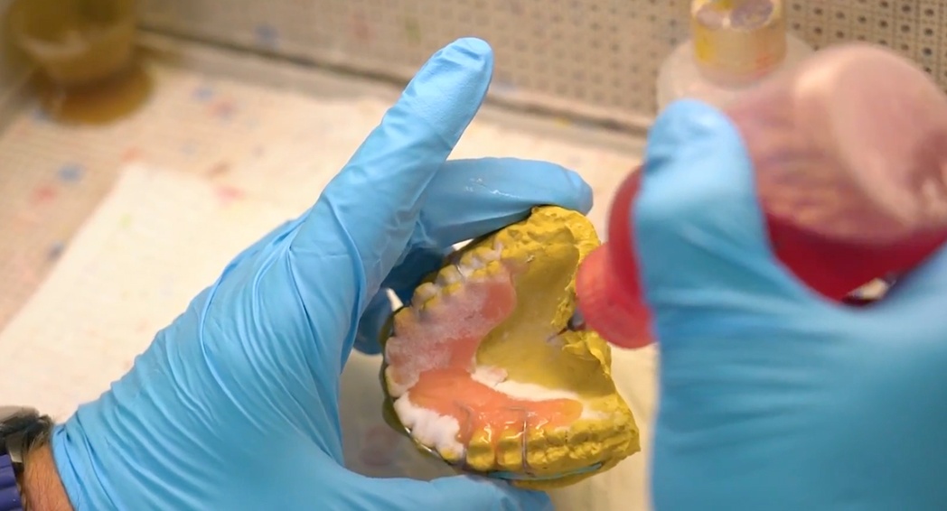 Hawley Retainer Instructions.pdf NINE STEPS TO CREATING A HAWLEY RETAINER
