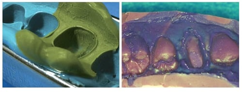 Dental Impression Error | Surface contamination