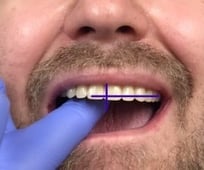 Midline and occlusal plane are incorrect.