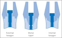 Dental Implant Abutment Connection