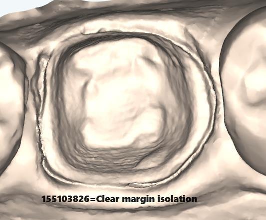 Clear Margin Isolation