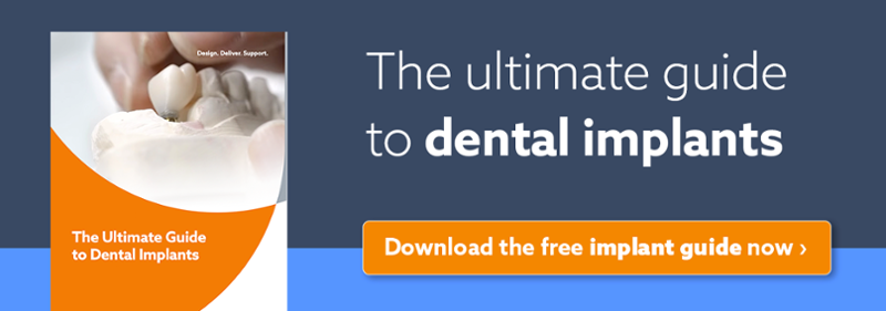 The Ultimate Guide To Dental Implants