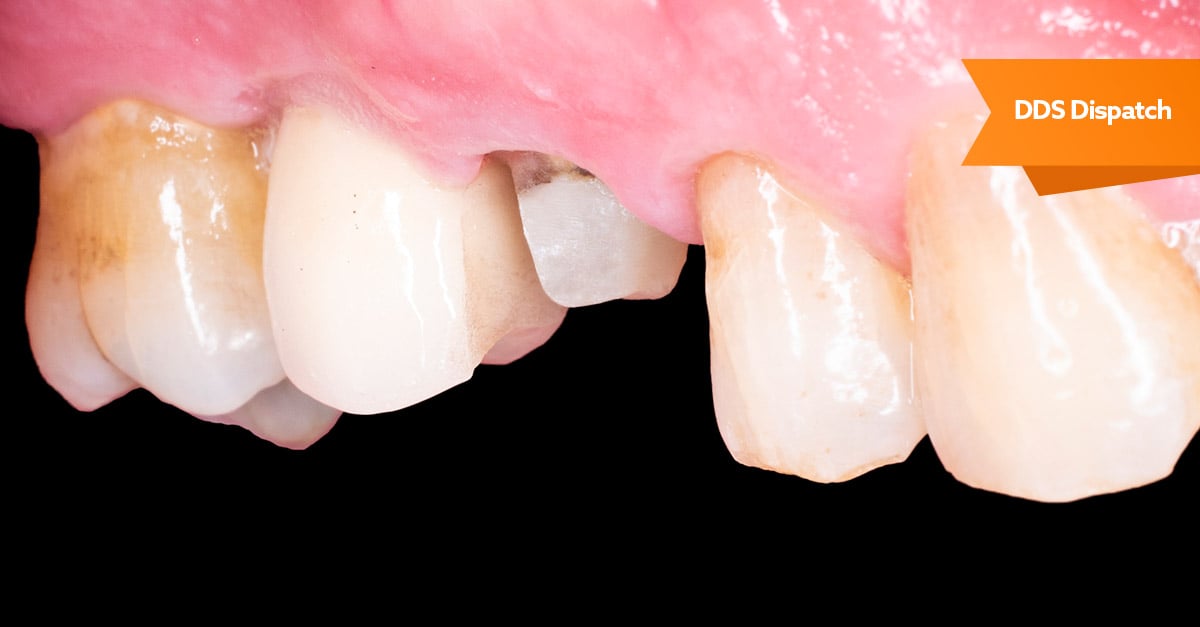 How to fix a dental crown that does not fit
