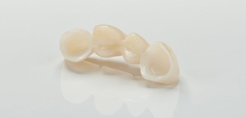MYTHS ABOUT ZIRCONIA DENTAL CROWNS