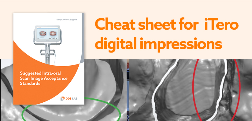 THE ULTIMATE CHEAT SHEET FOR ITERO DENTAL DIGITAL IMPRESSIONS