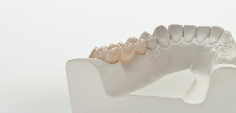 WHY DENTAL ZIRCONIA PRODUCTS ARE WORTH THE INVESTMENT